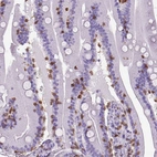 Immunohistochemical staining of human small intestine shows strong membranous positivity in lymphoid cells.