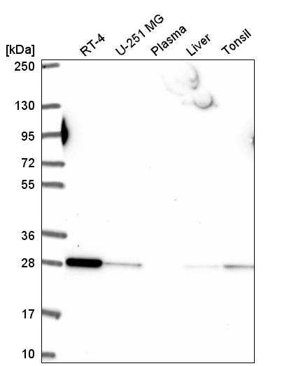 Anti-RAB5B Antibody