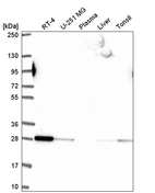 Anti-RAB5B Antibody