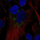 Immunofluorescent staining of human cell line SK-MEL-30 shows localization to vesicles.