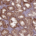 Immunohistochemical staining of human kidney shows moderate to strong cytoplasmic positivity in cells in tubules.