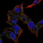 Anti-KAT14 Antibody