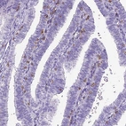 Immunohistochemical staining of human fallopian tube shows moderate membranous positivity in lymphoid cells.