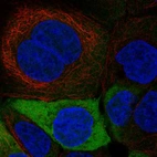 Immunofluorescent staining of human cell line A-431 shows localization to plasma membrane & cytosol.