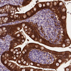 Immunohistochemical staining of human small intestine shows strong cytoplasmic positivity in glandular cells.