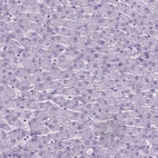 Immunohistochemical staining of human liver shows no positivity in hepatocytes as expected.