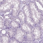 Immunohistochemical staining of human kidney shows no positivity in cells in tubules as expected.