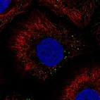 Immunofluorescent staining of human cell line HaCaT shows localization to vesicles.