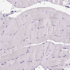 Immunohistochemical staining of human skeletal muscle shows no positivity in striated muscle fibers as expected.