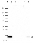 Lane 1: Marker [kDa] 250, 130, 95, 72, 55, 36, 28, 17, 10_br/_Lane 2: Human cell line RT-4_br/_Lane 3: Human cell line U-251 MG_br/_Lane 4: Human plasma_br/_Lane 5: Human Liver tissue_br/_Lane 6: Human Tonsil tissue