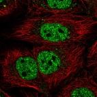 Immunofluorescent staining of human cell line HaCaT shows localization to nucleoplasm.