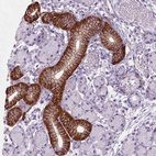 Anti-FXYD2 Antibody