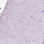 Immunohistochemical staining of human skeletal muscle shows no positivity in myocytes as expected.