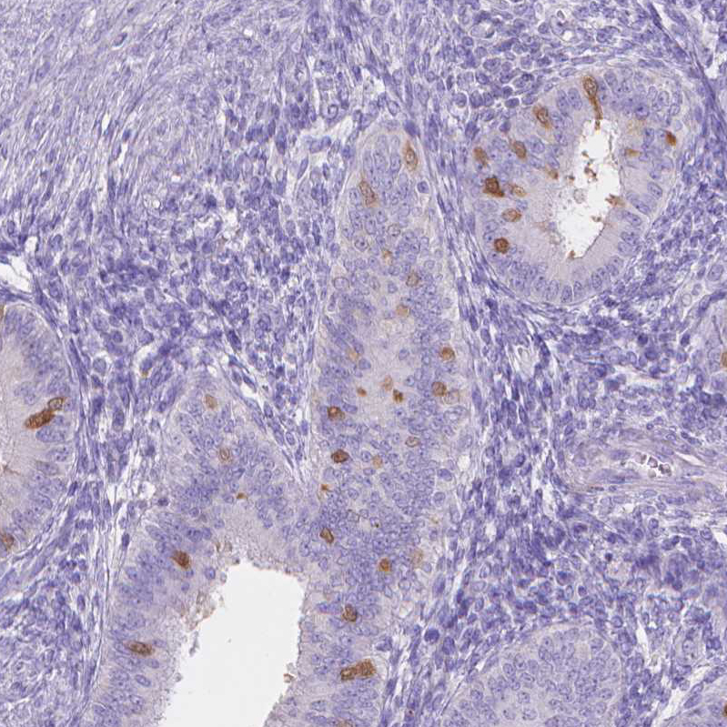 Anti-MMP11 Antibody