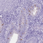 Anti-MMP11 Antibody