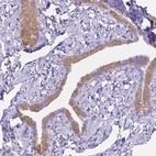 Immunohistochemical staining of human fallopian tube shows moderate cytoplasmic positivity in glandular cells.