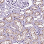 Immunohistochemical staining of human kidney shows moderate membranous positivity in cells in tubules.