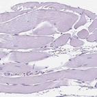 Immunohistochemical staining of human skeletal muscle shows no positivity in myocytes as expected.