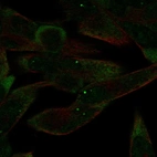 Immunofluorescent staining of human cell line RH-30 shows localization to nuclear bodies & cytosol.