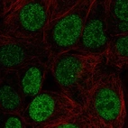 Immunofluorescent staining of human cell line MCF-7 shows localization to nucleoplasm.