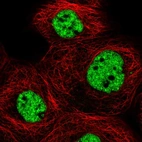 Immunofluorescent staining of human cell line A-431 shows localization to nucleoplasm.