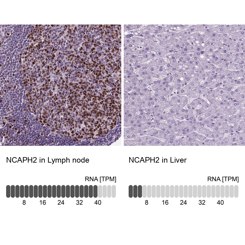 Anti-NCAPH2 Antibody