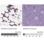 Anti-NCAPH2 Antibody