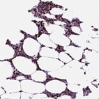 Immunohistochemical staining of human bone marrow shows high expression.