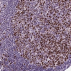 Immunohistochemical staining of human lymph node shows strong nuclear positivity in germinal center cells.