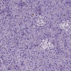 Immunohistochemical staining of human pancreas shows low expression as expected.
