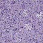 Anti-NCAPH2 Antibody