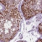 Immunohistochemical staining of human testis shows strong nuclear positivity in cells in seminiferous ducts.
