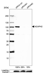 Anti-NCAPH2 Antibody