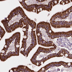 Immunohistochemical staining of human duodenum shows strong granular cytoplasmic positivity in glandular cells.