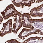 Immunohistochemical staining of human duodenum shows strong granular cytoplasmic positivity in glandular cells.