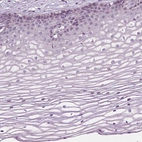 Immunohistochemical staining of human cervix, uterine shows no positivity in squamous epithelial cells as expected.