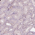 Immunohistochemical staining of human kidney shows no positivity in cells in tubules as expected.
