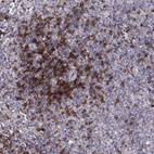 Anti-CD8A Antibody