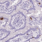 Immunohistochemical staining of human duodenum shows strong cytoplasmic positivity in endocrine glandular cells.
