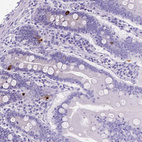 Immunohistochemical staining of human small intestine shows strong cytoplasmic positivity in endocrine glandular cells.