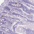 Immunohistochemical staining of human small intestine shows strong cytoplasmic positivity in endocrine glandular cells.
