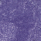 Immunohistochemical staining of human lymph node shows no positivity in non-germinal center cells as expected.