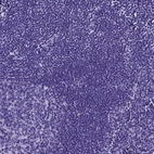 Immunohistochemical staining of human lymph node shows no positivity in non-germinal center cells as expected.