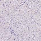 Anti-MLN Antibody