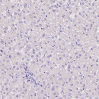 Immunohistochemical staining of human liver shows no positivity in hepatocytes as expected.