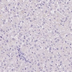 Immunohistochemical staining of human liver shows no positivity in hepatocytes as expected.