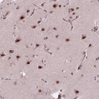 Immunohistochemical staining of human cerebral cortex shows high expression.