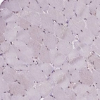 Immunohistochemical staining of human skeletal muscle shows low expression as expected.