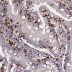 Immunohistochemical staining of human small intestine shows strong membranous positivity in lymphoid cells.
