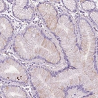 Immunohistochemical staining of human stomach shows weak cytoplasmic positivity in glandular cells.